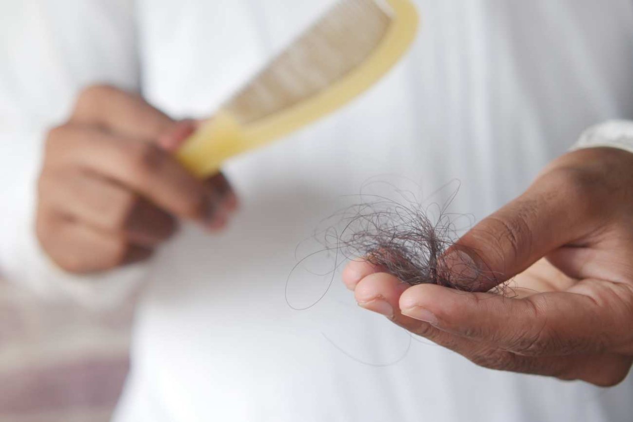 Caduta dei capelli: quando è normale e quando va controllata