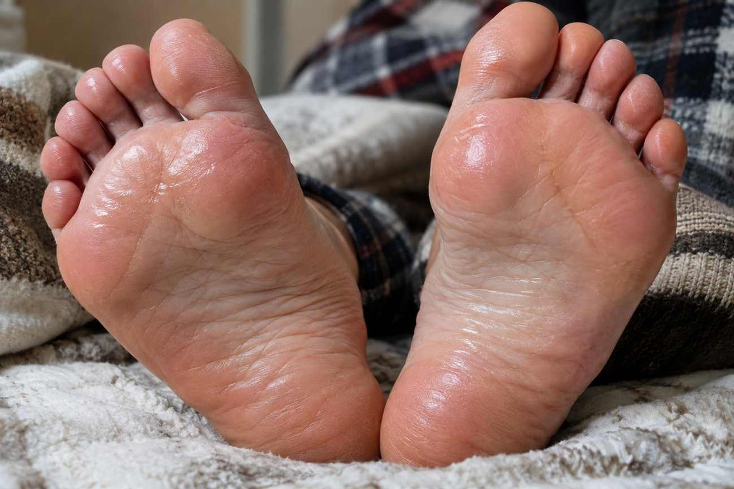 Piedi che sudano anche in inverno: le cause più comuni e come evitare i cattivi odori